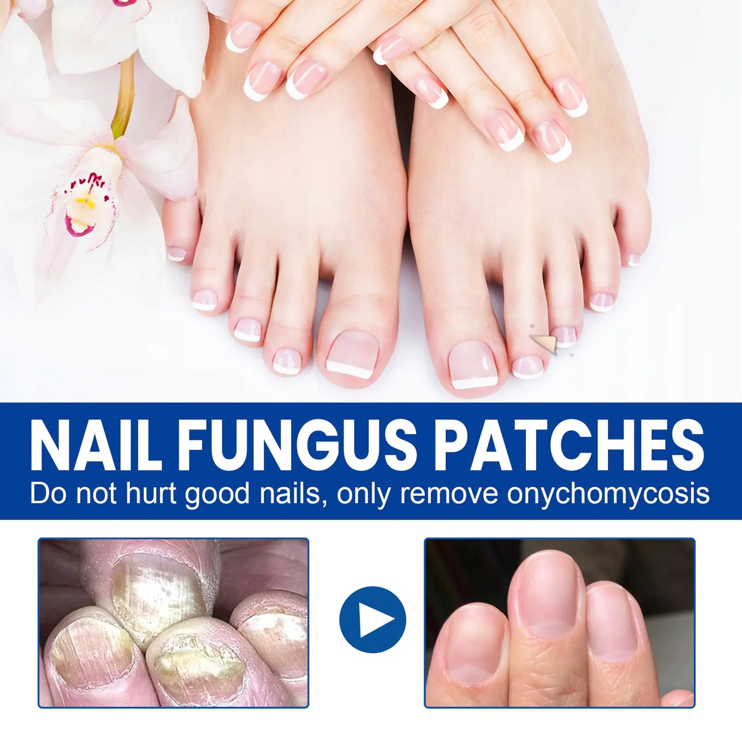 Nail Repair Bandage